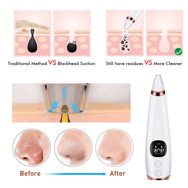 Facial microcry stalline blackhead skin beauty instrument